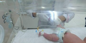 فحص ٥٠٠ طفل بالمبادرة الرئاسية للكشف المبكر عن الأمراض الوراثية للأطفال المبتسرين بالشرقية 1 - جريدة المساء