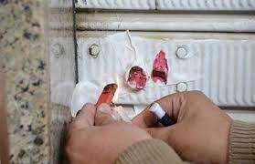 غلق 11 منشأة طبية خاصة خلال حملة مكبرة للعلاج الحر علي مركز ومدينه بسيون 27 - جريدة المساء