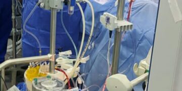 إجراء أول جراحة قلب مفتوح بمستشفيات صحة الشرقية بالزقازيق العام 1 - جريدة المساء