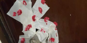 غلق مركز طبي شهير لتفتيت الحصوات.. بطنطا 1 - جريدة المساء