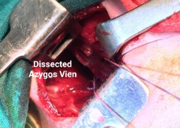 صحة القاهرة:  إنقاذ حياة طفل حديث الولادة يعاني من انسداد بالمرئ بمستشفى عين شمس العام 27 - جريدة المساء