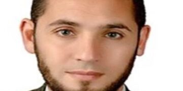 "انجاز علمى جديد بالجامعة اليابانية" .. تطوير سبائك تيتانيوم جديدة لصناعة الأجزاء التعويضية لجسم الانسان 2 - جريدة المساء "انجاز علمى جديد بالجامعة اليابانية" .. تطوير سبائك تيتانيوم جديدة لصناعة الأجزاء التعويضية لجسم الانسان 1 - جريدة المساء