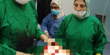 لأول مرة إستئصال ورم حميد يزن 2.5 كجم من كتف مريض بمستشفي الشلاتين 2 - جريدة المساء لأول مرة إستئصال ورم حميد يزن 2.5 كجم من كتف مريض بمستشفي الشلاتين 1 - جريدة المساء