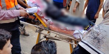 عملية جراحية لطفل بلا مأوى بالقاهرة وإعادته إلى أسرته بعد شهر من البحث 2 - جريدة المساء عملية جراحية لطفل بلا مأوى بالقاهرة وإعادته إلى أسرته بعد شهر من البحث 1 - جريدة المساء