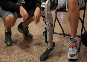 أجهزة تعويضية وأطرف صناعية لذوي الهمم وغير القادرين بالشرقية 15 - جريدة المساء