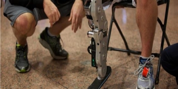 أجهزة تعويضية وأطرف صناعية لذوي الهمم وغير القادرين بالشرقية 1 - جريدة المساء