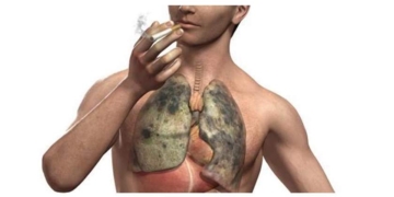 صندوق مكافحة الإدمان محذراً: التدخين يسبب سرطان الرئة والإصابة بالسكتة الدماغية 1 - جريدة المساء أضرار سرطانية بسبب التدخين