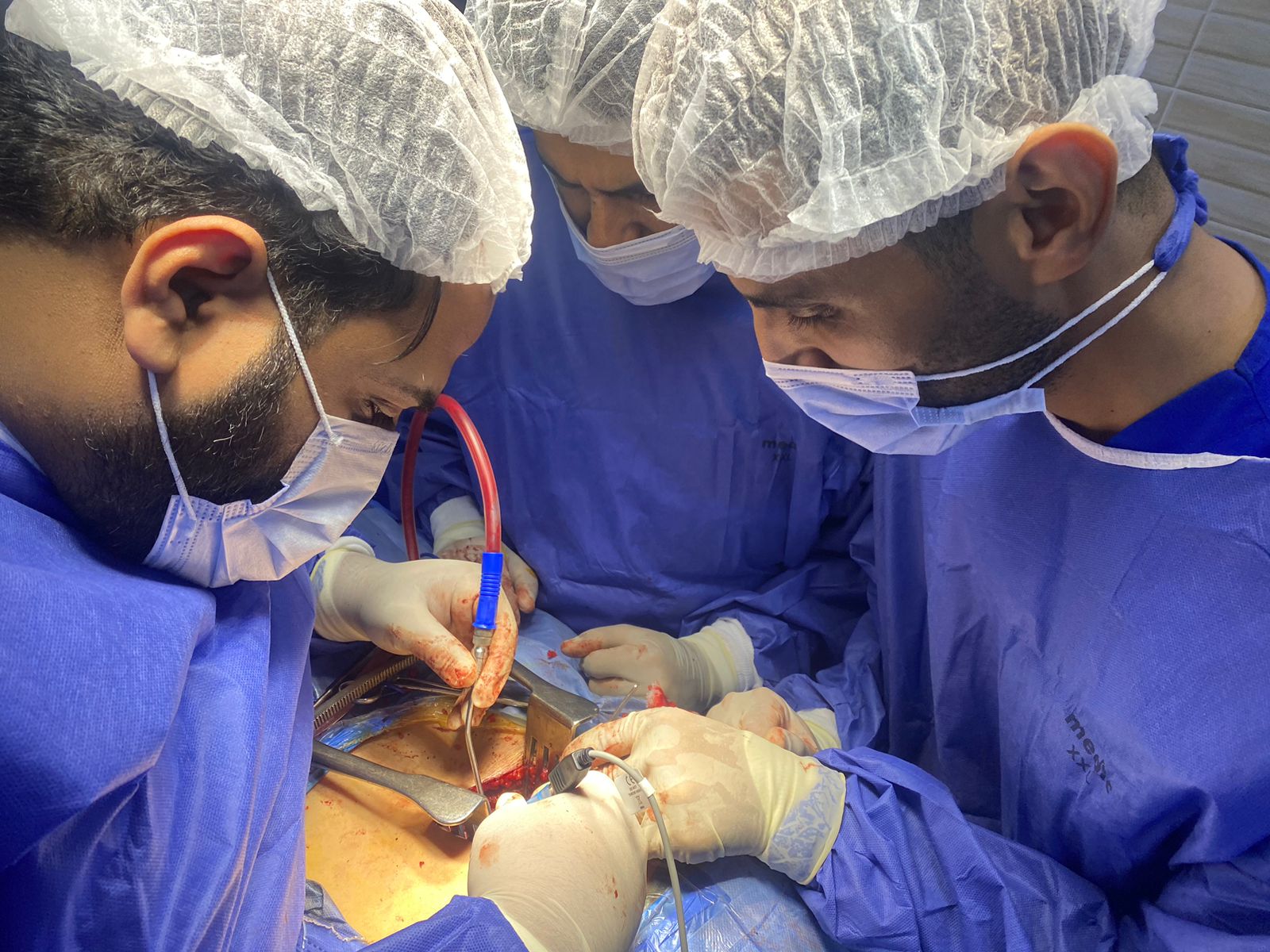 نجاح أول عملية جراحية للعمود الفقري بمستشفى أبوحماد المركزي - جريدة المساء