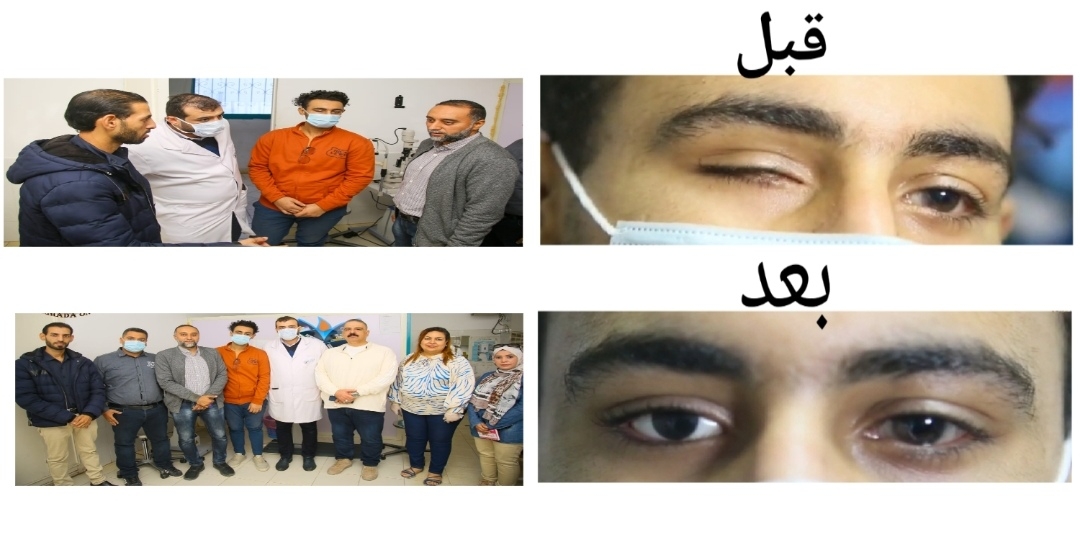 الصحه تنجح في إجراء عملية تركيب عين صناعية متحركة بمستشفى الغردقة العام والكشف علي ١٠٥٤ مواطن في قوافل طب العيون بالغردقة 19 - جريدة المساء