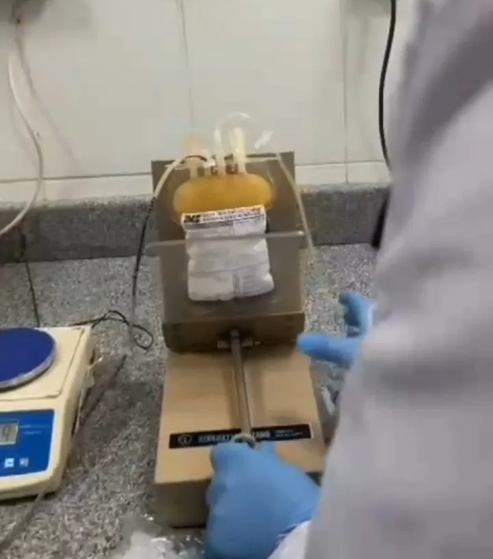 توفير مشتقات الدم بمستشفى الفشن المركزي لخدمة مرضي التليف الكبدي والغسيل الكلوي 19 - جريدة المساء