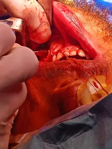 للمرة الأولى.. إجراء جراحة وجه وفكين دقيقة بمستشفى الحسينية المركزي بالشرقية 27 - جريدة المساء