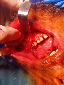 للمرة الأولى.. إجراء جراحة وجه وفكين دقيقة بمستشفى الحسينية المركزي بالشرقية 25 - جريدة المساء