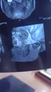 للمرة الأولى.. إجراء جراحة وجه وفكين دقيقة بمستشفى الحسينية المركزي بالشرقية 23 - جريدة المساء