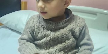 جامعة القاهرة..اجراء اول جراحة قلب مفتوح لطفل غزاوي بابو الريش الياباني 1 - جريدة المساء