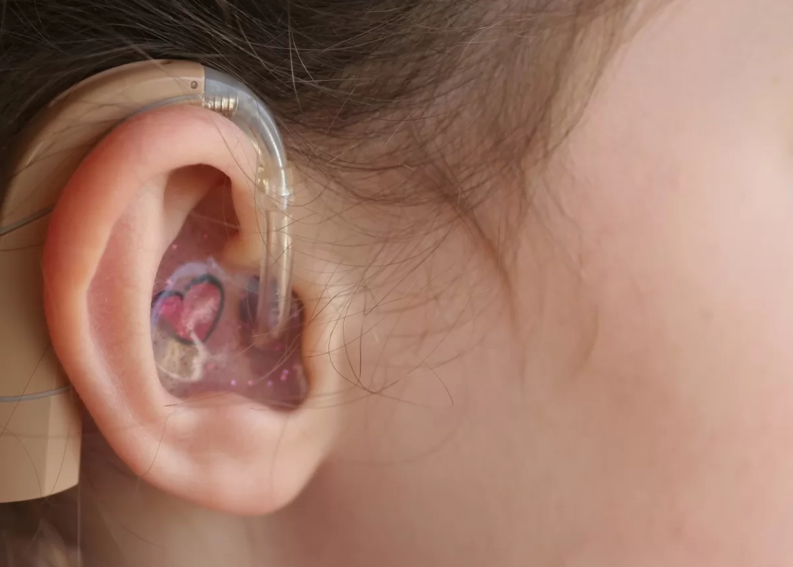 73 مركزًا لغويًا و6 مؤسسات: جهود مكثفة لتأهيل الصم وضعاف السمع في مصر 18 - جريدة المساء تركيب سماعات لضعاف السمع