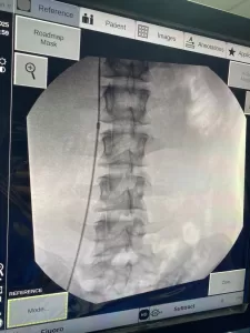 فى تدخل جراحى نادر لأول مرة بمستشفى الزقازيق العام ..إنقاذ حياة مريض بجلطة وريدية حادة 25 - جريدة المساء