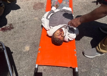 كدواني يتفقد موقع حادث تصادم وانقلاب "بيك أب" تقل 34 طفلًا بملوي 17 - جريدة المساء