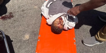 كدواني يتفقد موقع حادث تصادم وانقلاب "بيك أب" تقل 34 طفلًا بملوي 1 - جريدة المساء