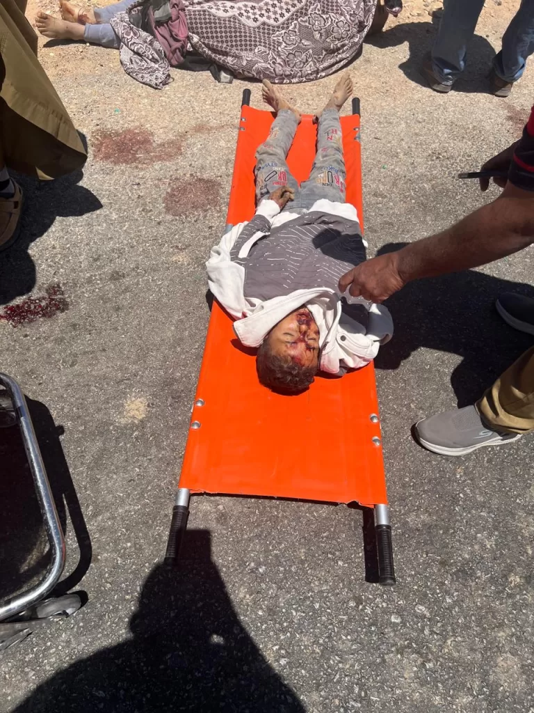 كدواني يتفقد موقع حادث تصادم وانقلاب "بيك أب" تقل 34 طفلًا بملوي 25 - جريدة المساء