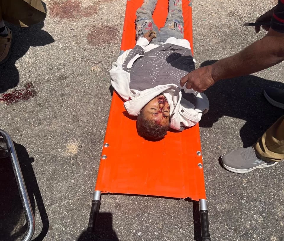 كدواني يتفقد موقع حادث تصادم وانقلاب "بيك أب" تقل 34 طفلًا بملوي 17 - جريدة المساء