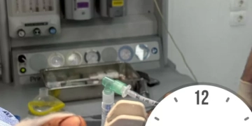 إنجاز طبي بمستشفى السنبلاوين: إنقاذ يد مريض من البتر في جراحة دقيقة 1 - جريدة المساء