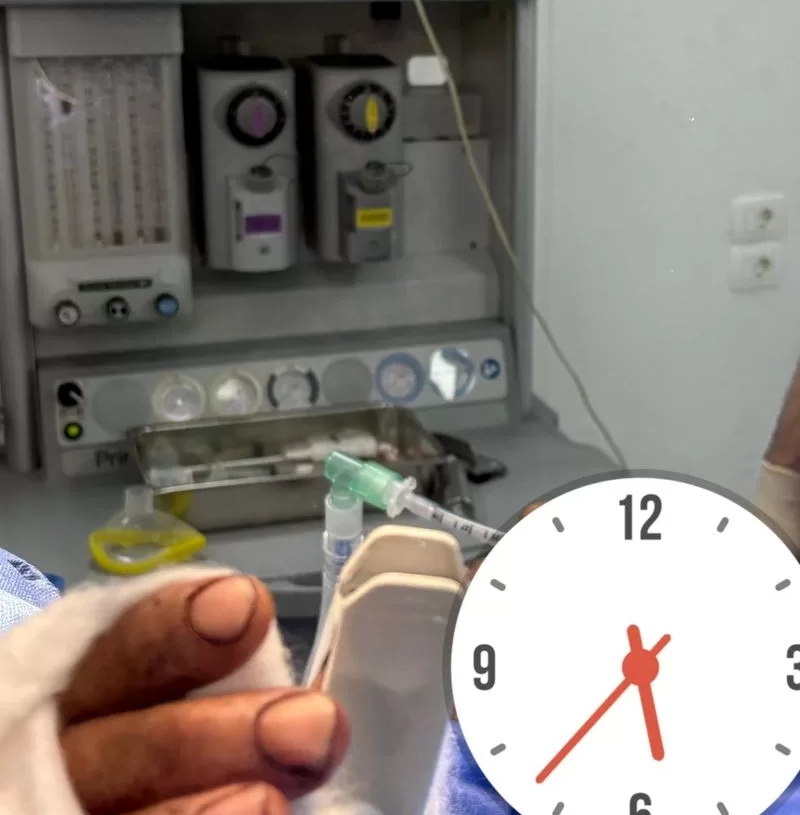 إنجاز طبي بمستشفى السنبلاوين: إنقاذ يد مريض من البتر في جراحة دقيقة 19 - جريدة المساء