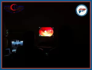 إنجاز طبي بمستشفى كبد ههيا.. مناظير القنوات المرارية تنقذ مرضى من مضاعفات خطيرة بدقة وكفاءة 23 - جريدة المساء