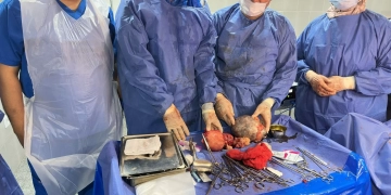 فريق طبي بمستشفى قنا يستأصل ورما خطيرا وينقذ حياة مريضة 2 - جريدة المساء فريق طبي بمستشفى قنا يستأصل ورما خطيرا وينقذ حياة مريضة 1 - جريدة المساء