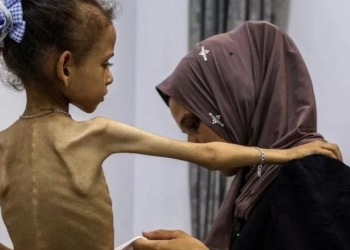 الاحتلال يجوع أطفال غزة