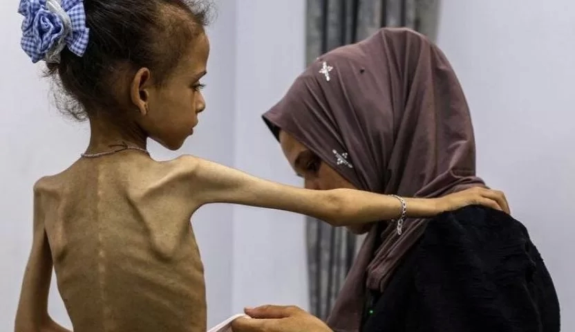 احتلال غزة قد يكلف إسرائيل 49 مليار دولار سنويًا 16 - جريدة المساء الاحتلال يجوع أطفال غزة