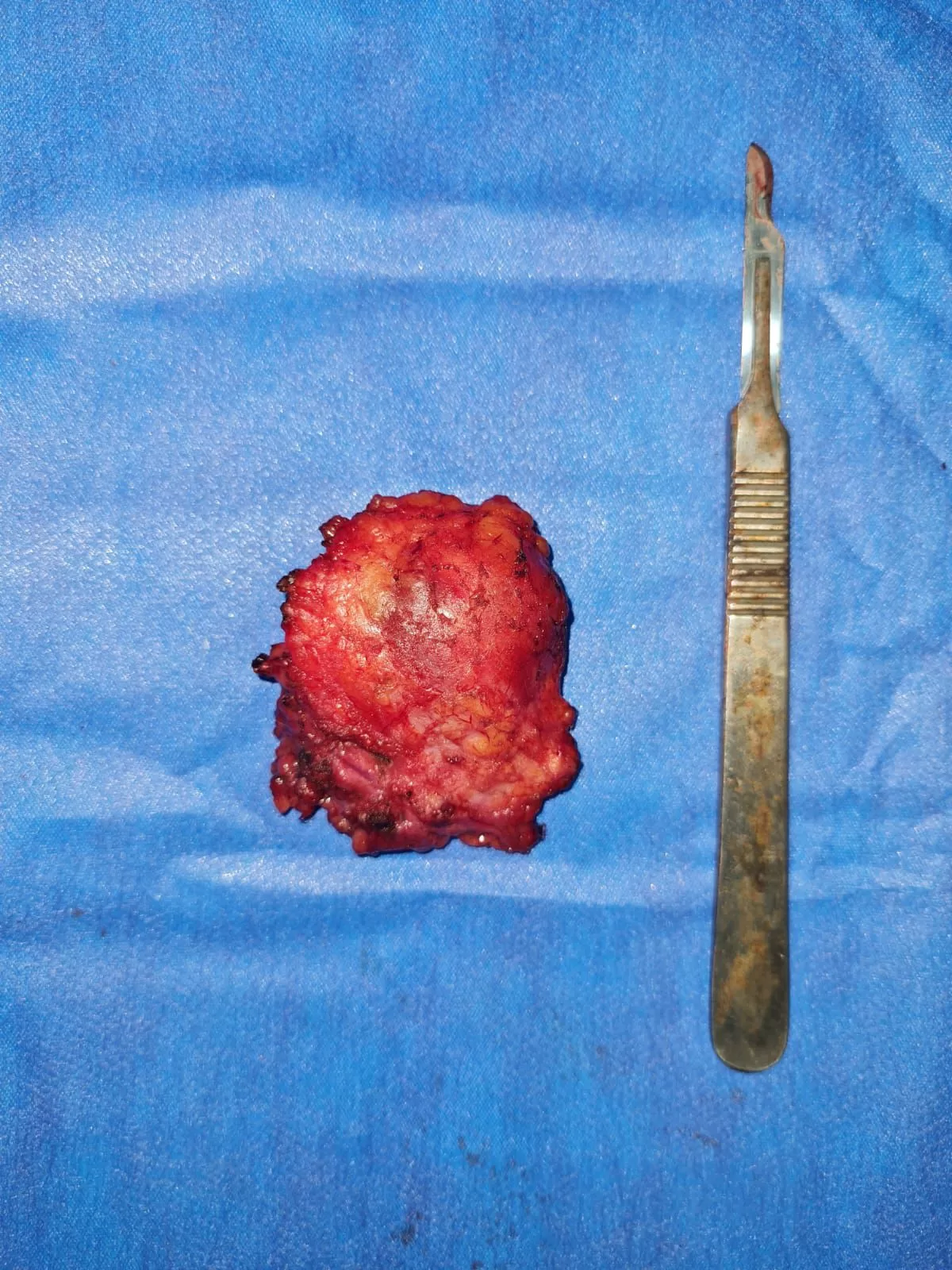 جراحة دقيقة بمستشفى قنا العام تنقذ مريضة من ورم نادر بالغدة النكافية دون المساس بأعصاب الوجه 25 - جريدة المساء