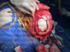 إنقاذ شاب بحادث سير وإجراء جراحة معقدة بمستشفى الشيخ زايد التخصصي 20 - جريدة المساء