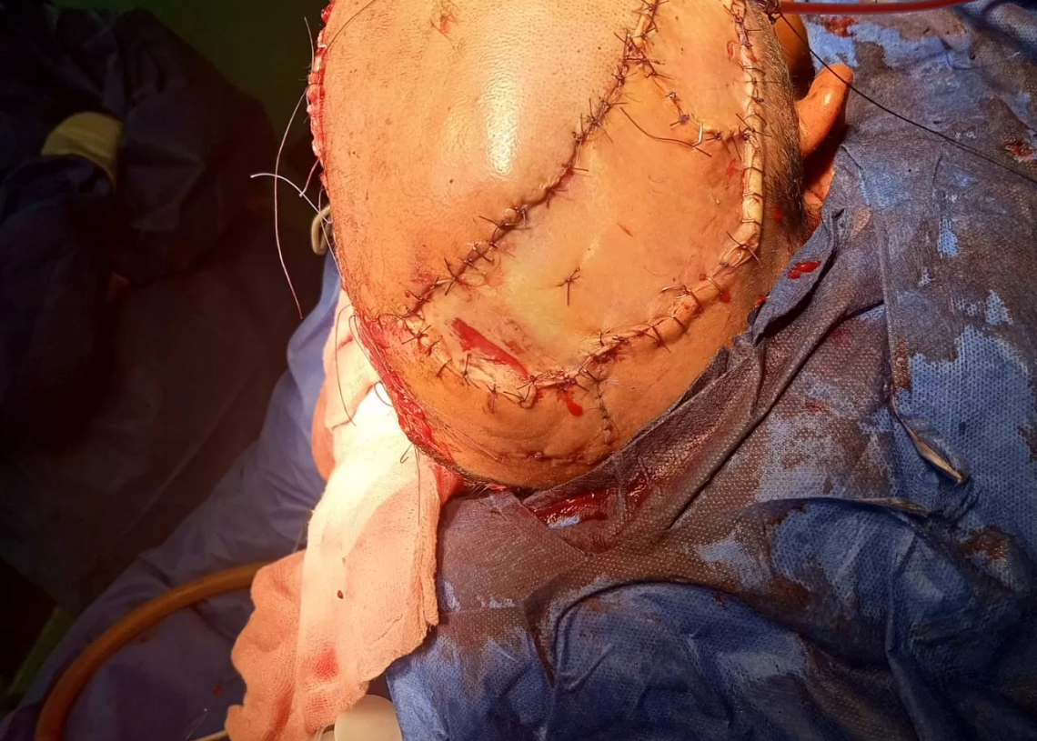 إنقاذ شاب بحادث سير وإجراء جراحة معقدة بمستشفى الشيخ زايد التخصصي 18 - جريدة المساء