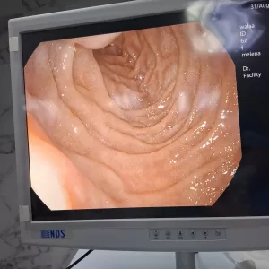 لأول مرة.. مناظير الجهاز الهضمي بمستشفى الشروق المركزي ومواعيد الكشف 21 - جريدة المساء