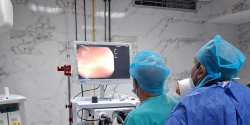 لأول مرة.. مناظير الجهاز الهضمي بمستشفى الشروق المركزي ومواعيد الكشف 1 - جريدة المساء