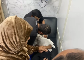 إنقاذ طفلة بالشروق بعد إصابة خطيرة في الوجه 17 - جريدة المساء