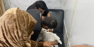 إنقاذ طفلة بالشروق بعد إصابة خطيرة في الوجه 1 - جريدة المساء