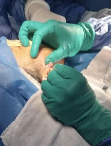 مستشفى الشروق ينقذ مريضًا بأول جراحة دقيقة لمفصل الفك 23 - جريدة المساء