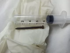 فريق طبى بمعهد كبد المنوفية ينقذ طفلة من الموت.. استخرج مسمارا من أمعائها في 20 دقيقة 21 - جريدة المساء