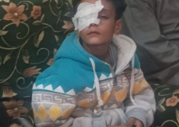 توجيه عاجل من محافظ قنا بشأن طفل فقد عينه على يد معلم 27 - جريدة المساء