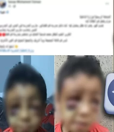 الداخلية تكشف حقيقة تعرض طفل للضرب داخل مدرسة بقنا 19 - جريدة المساء