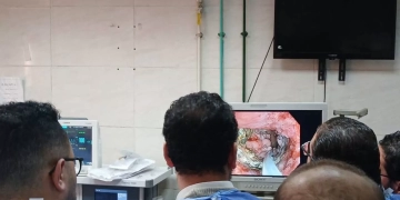 دعامة معدنية تنقذ حياة مريضة مصابة بانسداد الإثني عشر بالمنوفية 2 - جريدة المساء دعامة معدنية تنقذ حياة مريضة مصابة بانسداد الإثني عشر بالمنوفية 1 - جريدة المساء