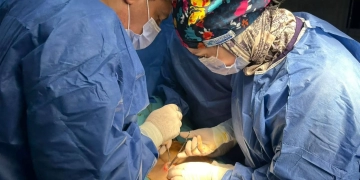 نجاح 96 عملية جراحية بمستشفى سرس الليان ضمن «يوم في حب مصر» 1 - جريدة المساء