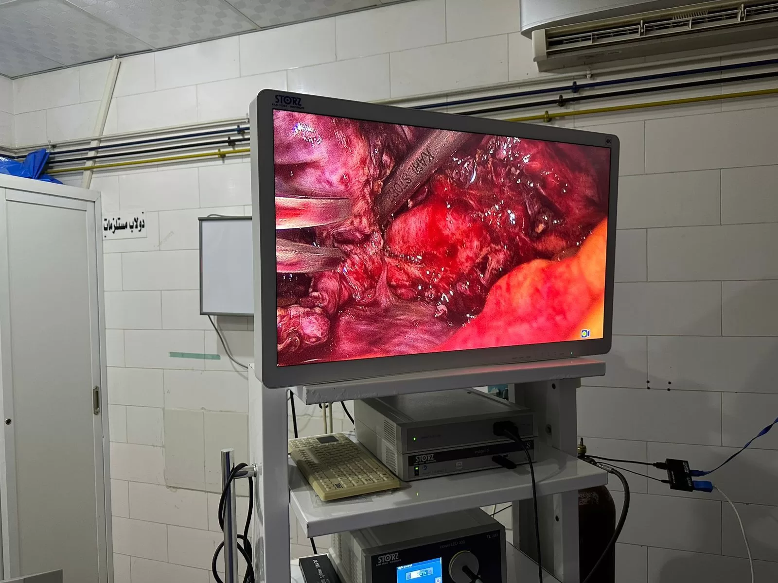 مستشفى قنا العام تحقق إنجازًا طبيًا في جراحات بطانة الرحم المهاجرة 29 - جريدة المساء