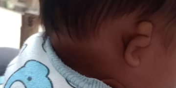 همسة لوزير الصحة 1 - جريدة المساء