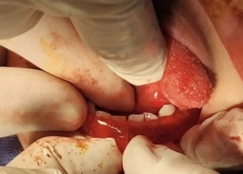 إنقاذ فتاة من كسر بالفك بمستشفى الشروق.. وأمل محمود: جاهزون للطوارئ 25 - جريدة المساء