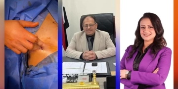 أطباء مستشفى سوهاج العام يعيدون الوظيفة الطبيعية ليد شاب أصيب ببتر فى السبابة 1 - جريدة المساء