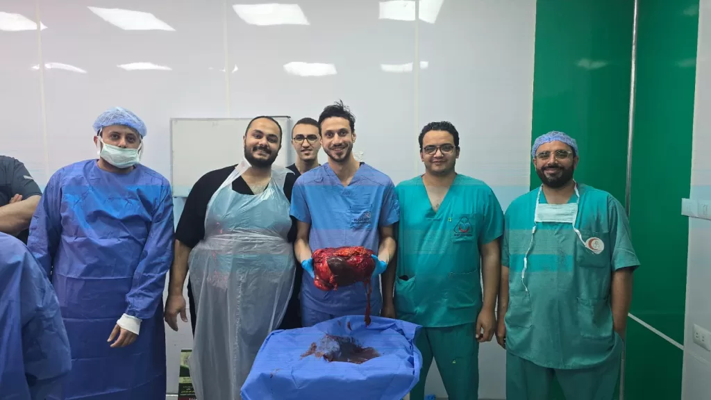 المنوفية: استئصال ورم يزن 30 كيلو من بطن شاب بـ"معهد الجامعة" 23 - جريدة المساء