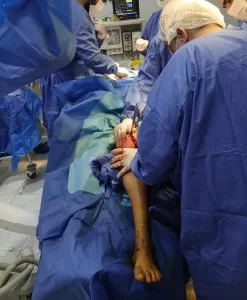 من المخ والأعصاب إلى البنكرياس والقلب.. مستشفيات الشرقية تجري ٤٤ جراحة كبرى ودقيقة 25 - جريدة المساء
