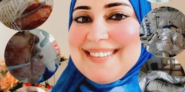  الأطباء المعالجون لرئيسة قرية تفتيش أبوسكين : مازالت حالتها حرجه 1 - جريدة المساء